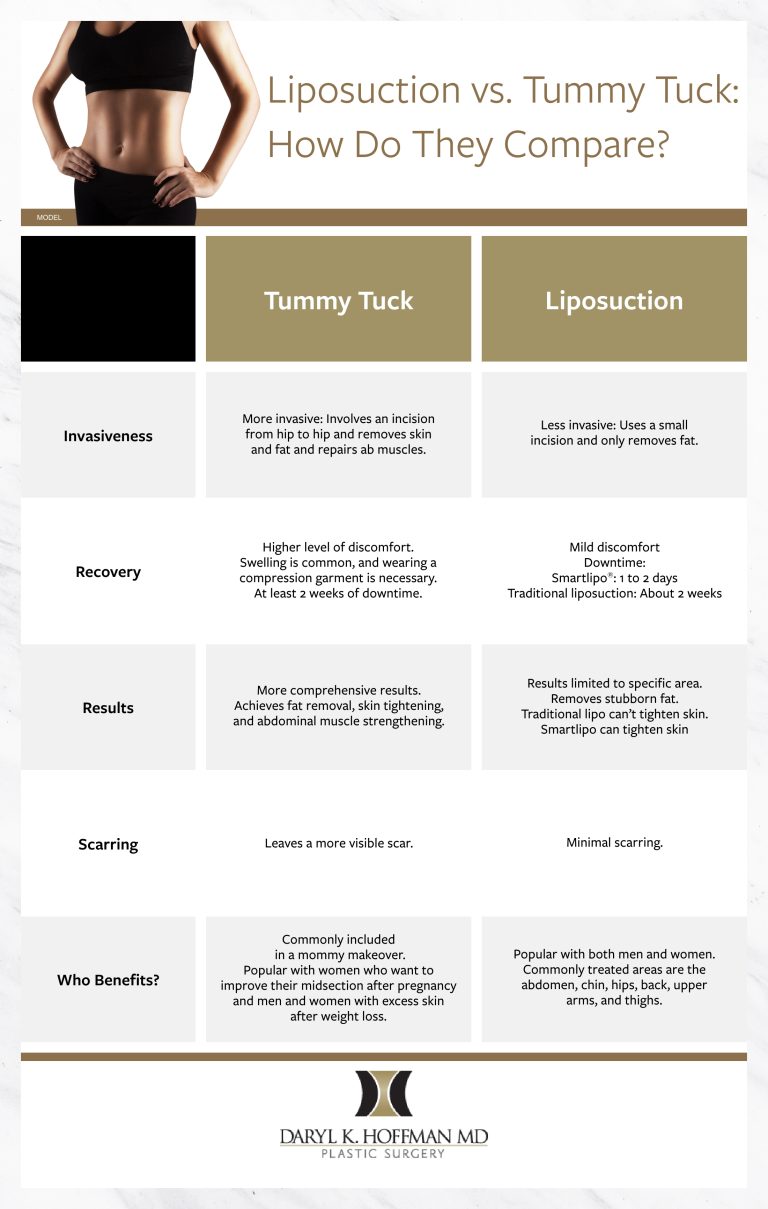 Infographic What You Need To Know About Liposuction Vs Tummy Tuck